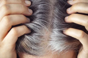 grey hair