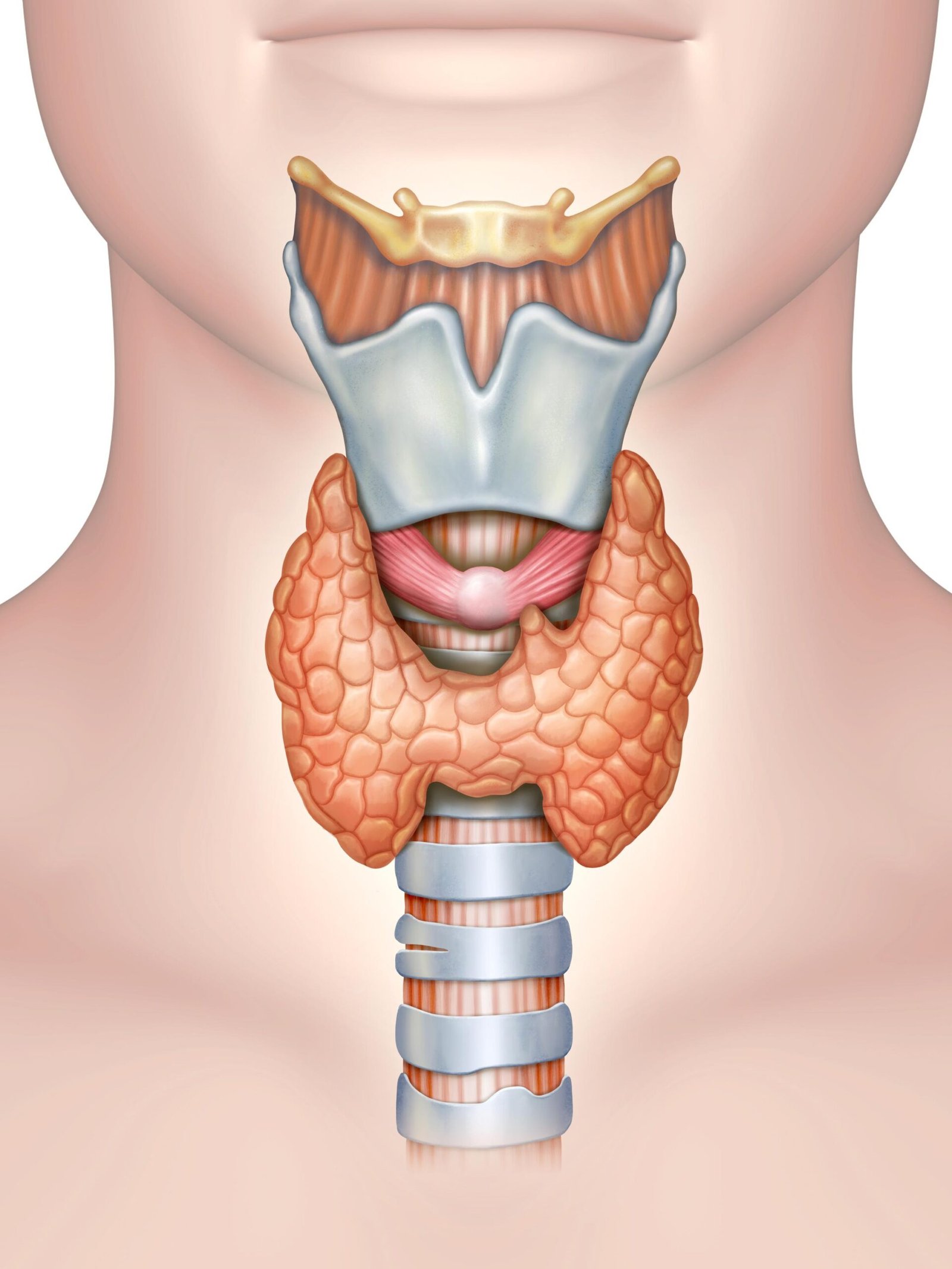 Hashimoto's Thyroiditis symptoms, causes, diagnosis and treatment