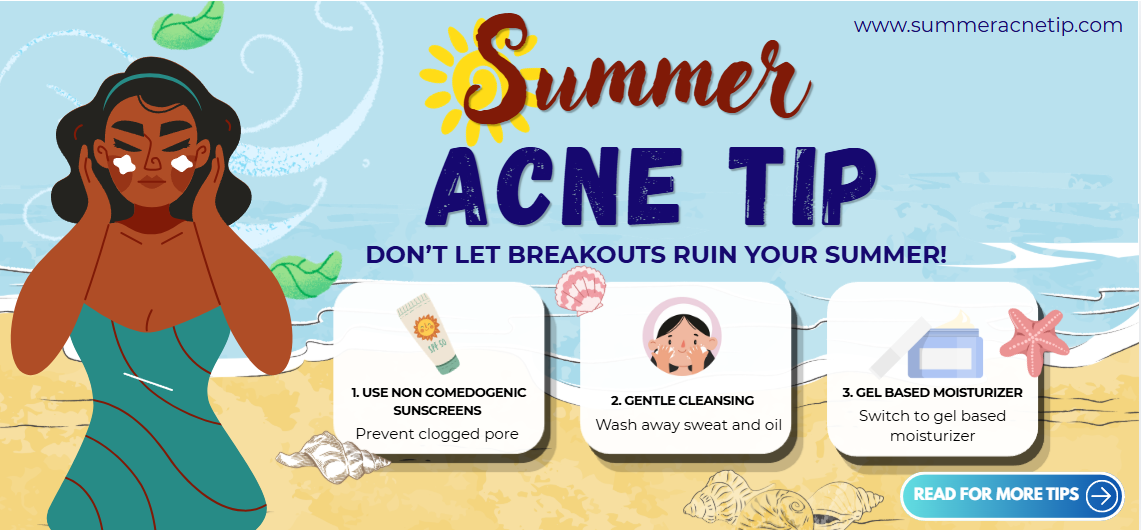 Summer Acne Tips: Don’t Let Breakouts Ruin Your Glow