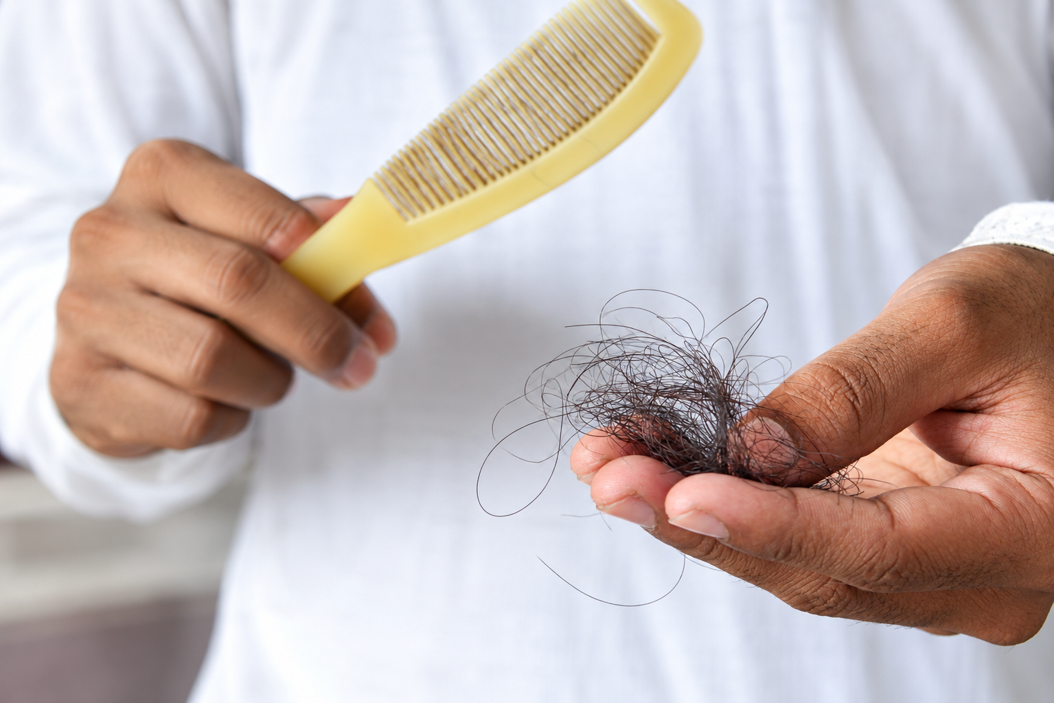 Hair Fall Causes and Best Hair Care Routine to Reduce Hair Fall !!